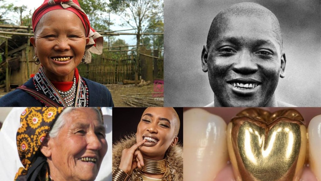 Fascinating Facts About Golden Tooth Grills and Their Global Popularity