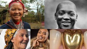 Golden Teeth